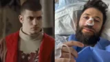 Stan yanevski, l’attore di viktor krum, operato per difficoltà respiratorie