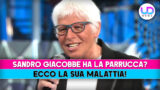 Sandro Giacobbe e la parrucca: scopri la verità sulla sua malattia