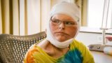 1000-Lb Sisters: le 5 migliori foto di Tammy Slaton dopo l’intervento di chirurgia estetica