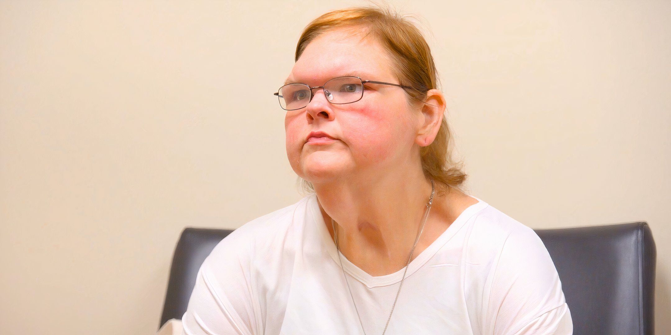 Storia medica di tammy slaton nelle 1000-lb sisters: oltre la chirurgia di rimozione della pelle?