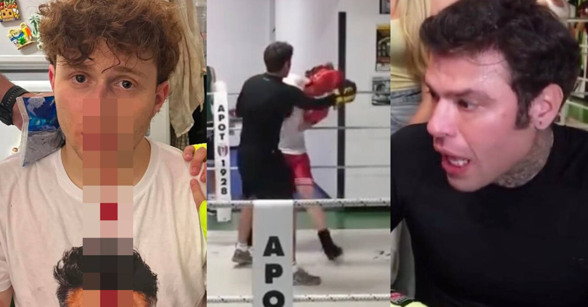 Fedez rompe il naso a un famoso e sorprende tutti Fedez rompe il naso a un famoso e sorprende tutti