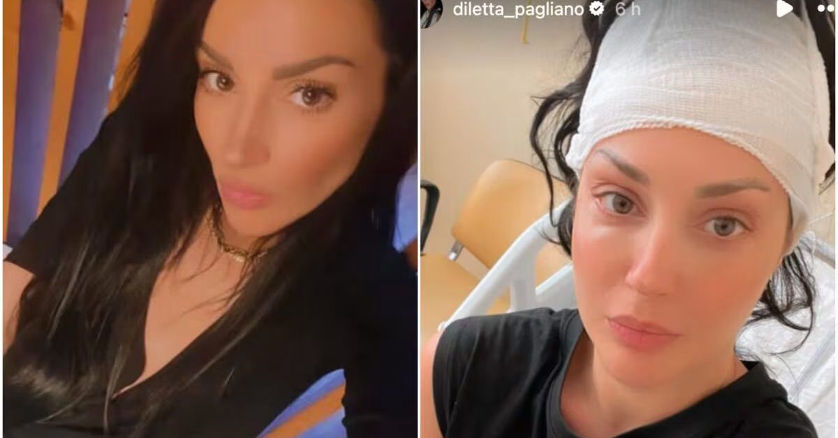 Intervento di oltre dieci ore: la vera storia di un volto di uomini e donne in ospedale Intervento di oltre dieci ore: la vera storia di un volto di uomini e donne in ospedale