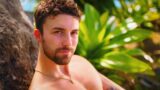 Zac Woodworth: la sorprendente procedura prima di Love Island USA e tutto quello che devi sapere