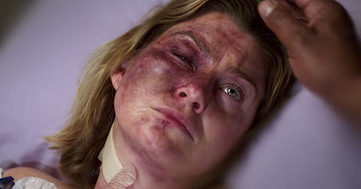 Meredith e la cicatrice sul volto: scopri l’origine dell’iconico segno di grey’s anatomy Meredith e la cicatrice sul volto: scopri l’origine dell’iconico segno di grey’s anatomy