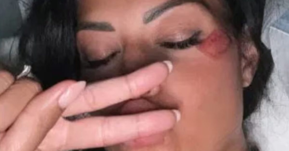 Incidente volto canale 5: paura per le sue condizioni di salute Incidente volto canale 5: paura per le sue condizioni di salute