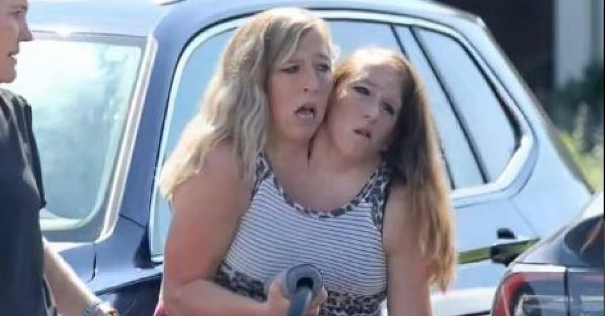 Gemelle siamesi Abby e Brittany diventano mamme: scopri chi è la madre biologica