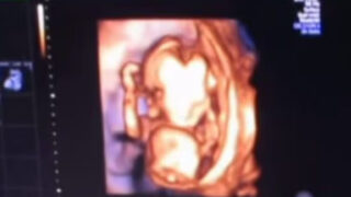 Coppia vip accoglie prima figlia: grande gioia tra i fan