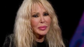 Ivana Spagna condivide il suo drammatico intervento di trapianto di pelle after incidente