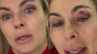 Martina colombari e l episodio shock con occhio nero paura e tensione