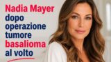 Nadia Mayer dopo operazione per tumore basalioma al volto