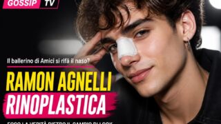 Ramon Agnelli di Amici si è rifatto il naso